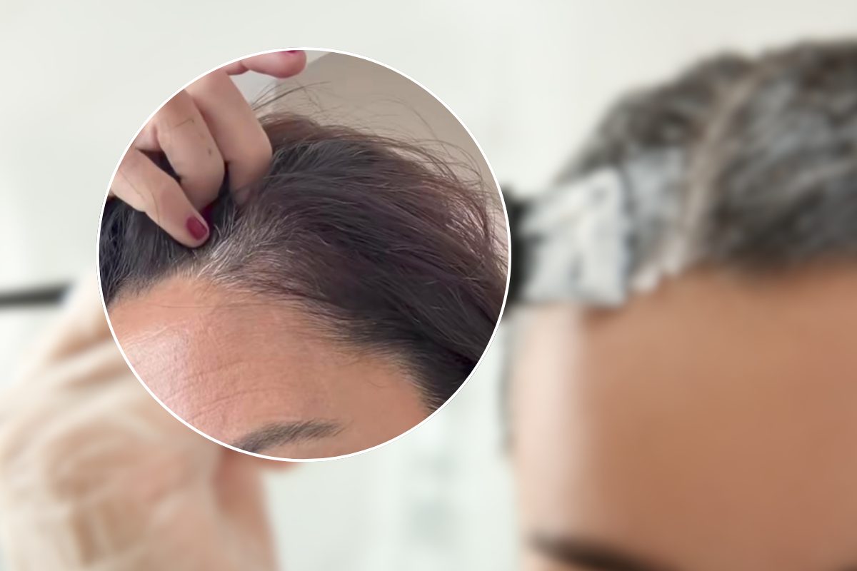 Riga di capelli bianchi